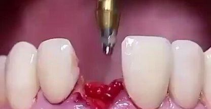 درمانگاه دندانپزشکی پارس کاشان