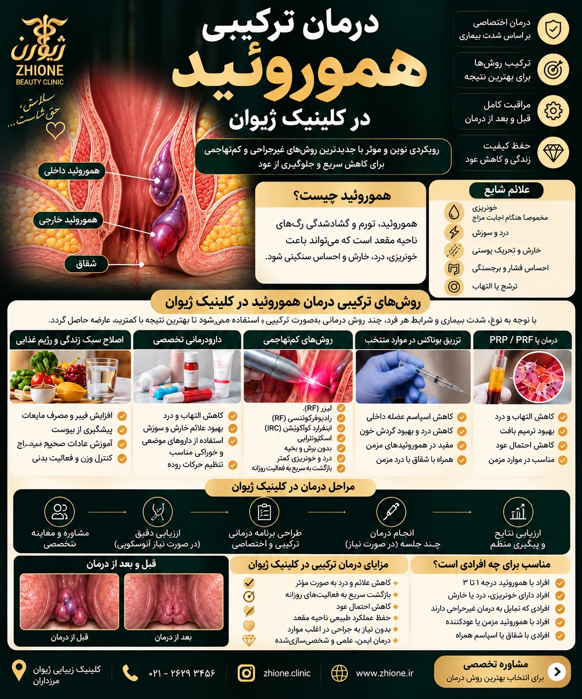 کلینیک تخصصی درمان هموروئید (بواسیر)