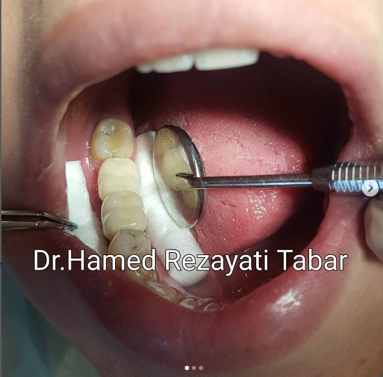 دندانپزشکی دکتر حامد رضایتی تبار