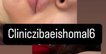 كلينيك زيبايی شمال  با مشاوره عقبايی