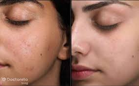 خدمات فیشیال