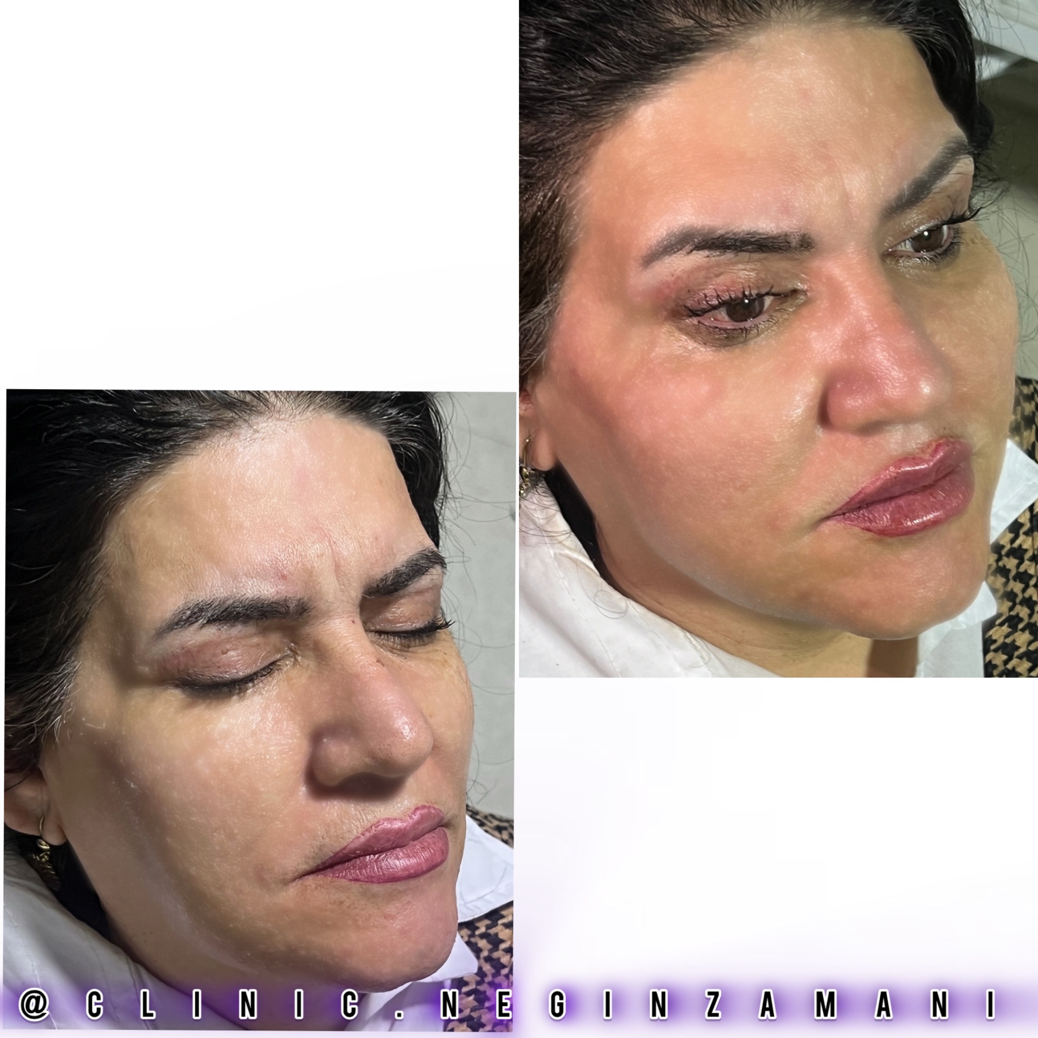 کلینیک زیبایی نگین زمانی