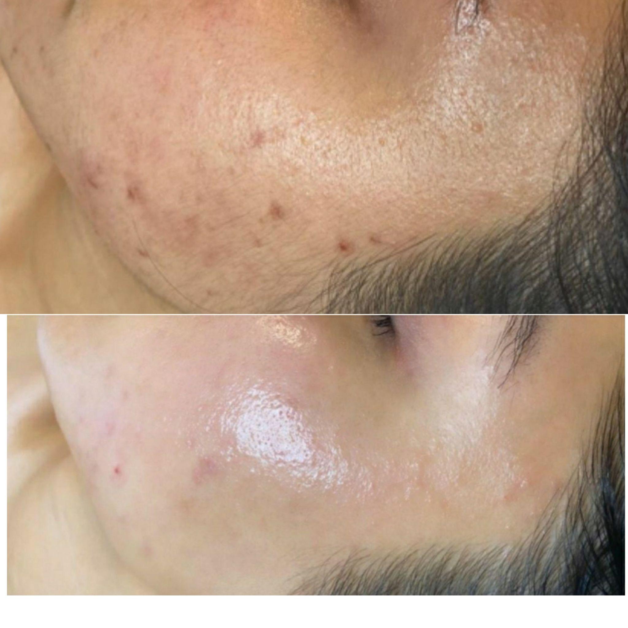 پاكسازى و فيشال پوست تى تى