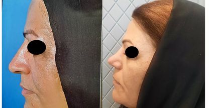 دکتر ابوالفضل فاتحی میبدی