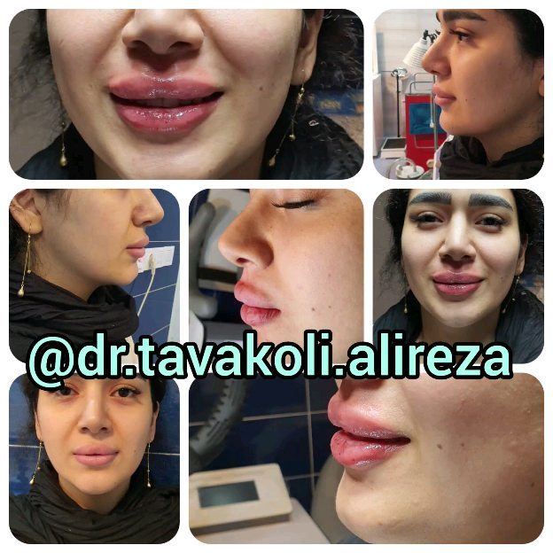 کلینیک زیبایی دکترعلیرضاتوکلی