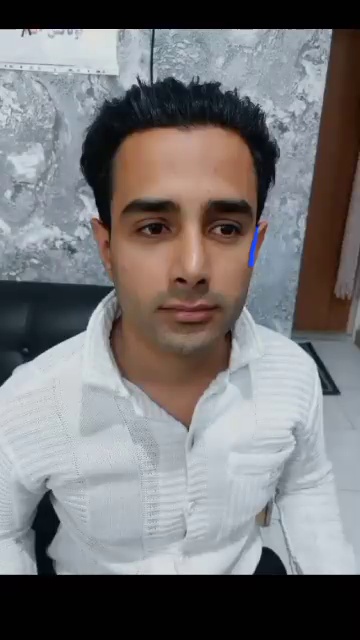 مرکزکلینیک لیزر زیبایی پوست و مو آسا