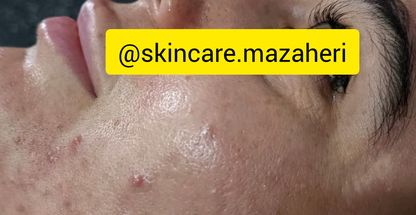 آموزشگاه پاکسازی پوست مظاهری