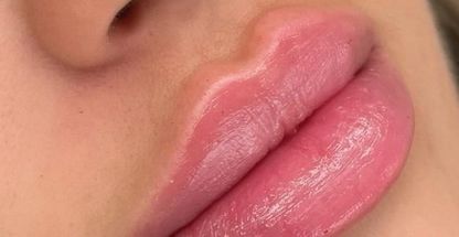 کلینیک زیبایی اُرکیده