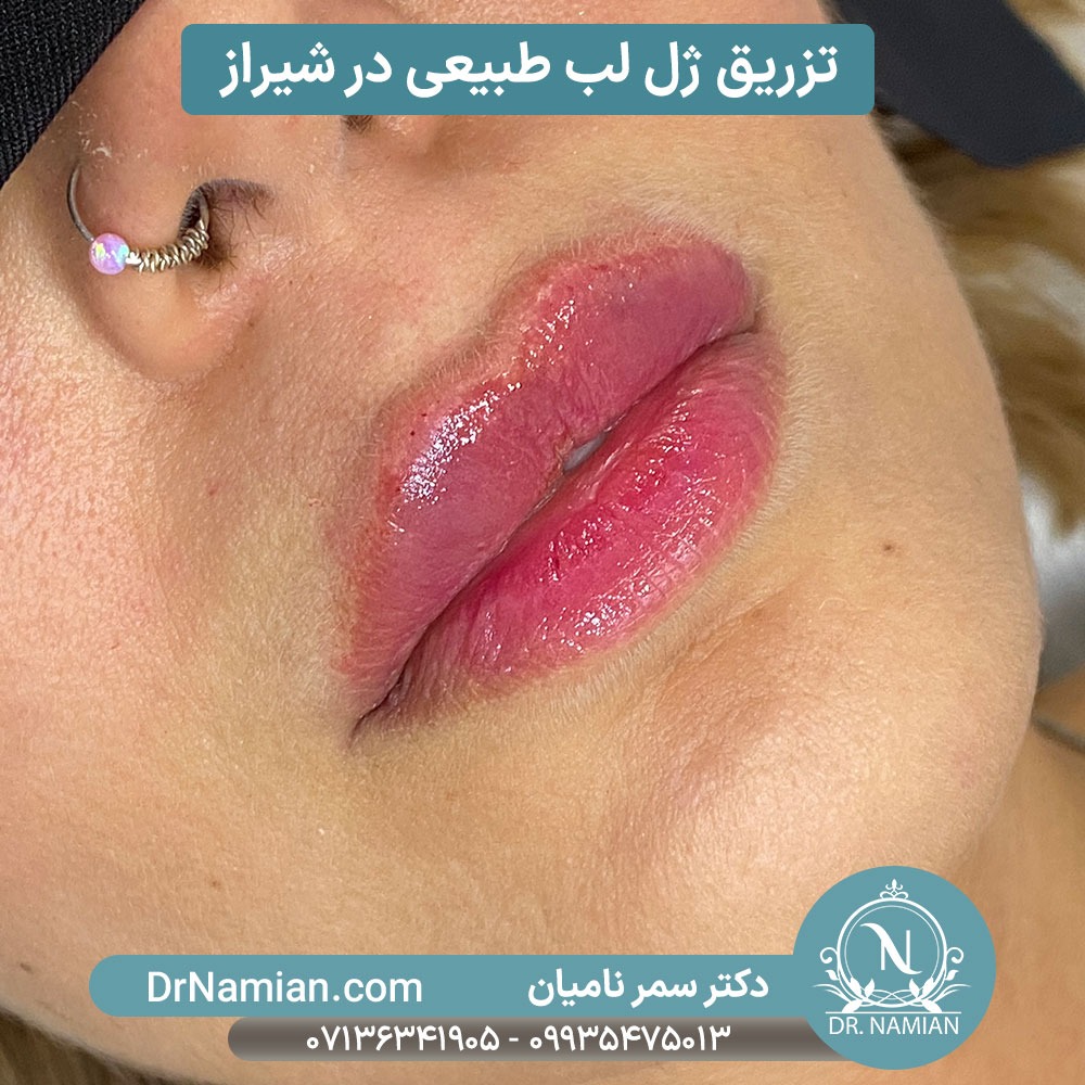 مطب زیبایی دکتر سمر نامیان