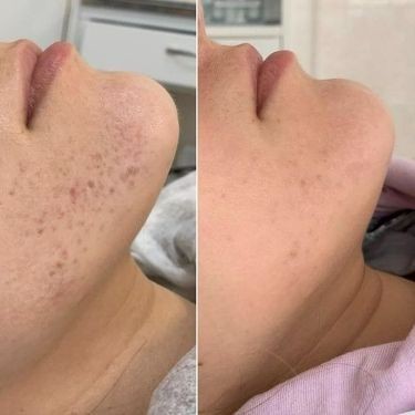 خدمات تخصصی پوست و مو لیلاک