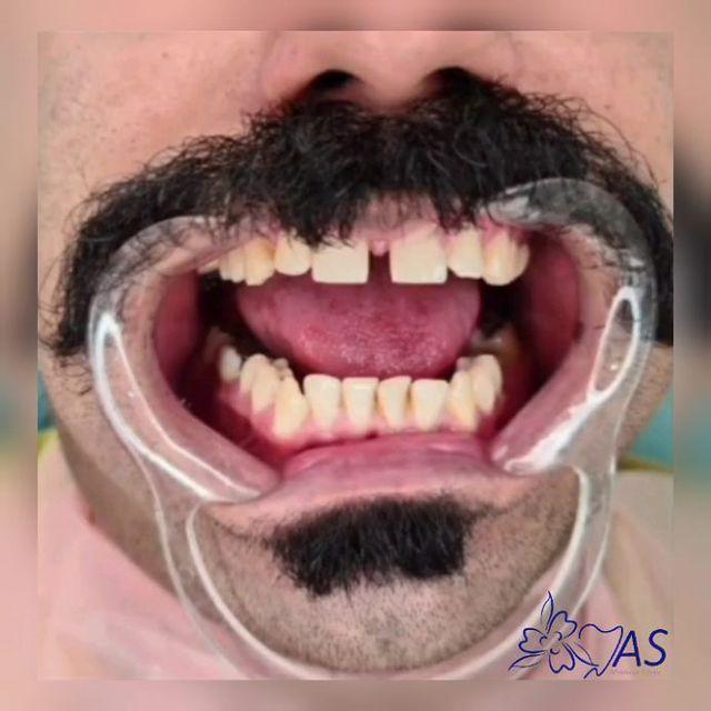 مرکز ایمپلنت و زیبایی یاس