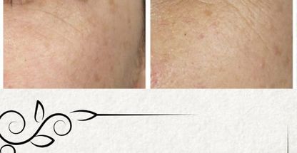 لیزر بیوتی آفیس