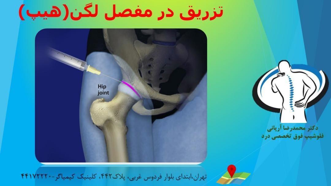 دکتر محمد رضا آریانی(فلوشیپ)