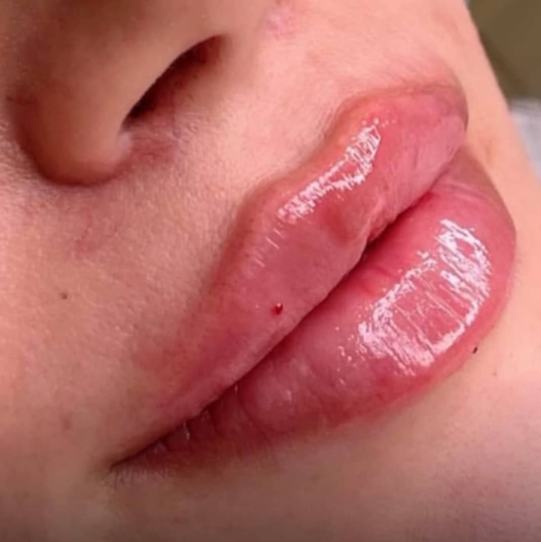 برفین اسکین