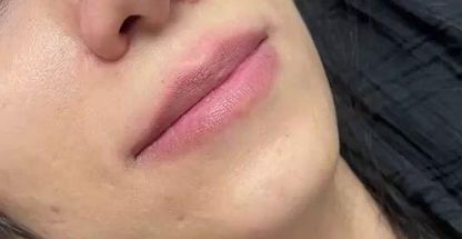 کلینیک پوست و مو و زیبایی لیزر نیو فیس