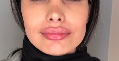 مطب زیبایی دکتر پژوهی