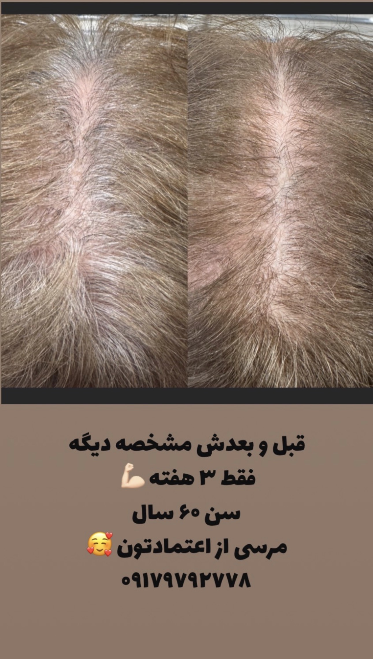 مژده