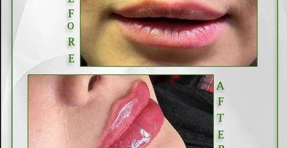 مجموعه زیبایی پوست و مو سارا نیری