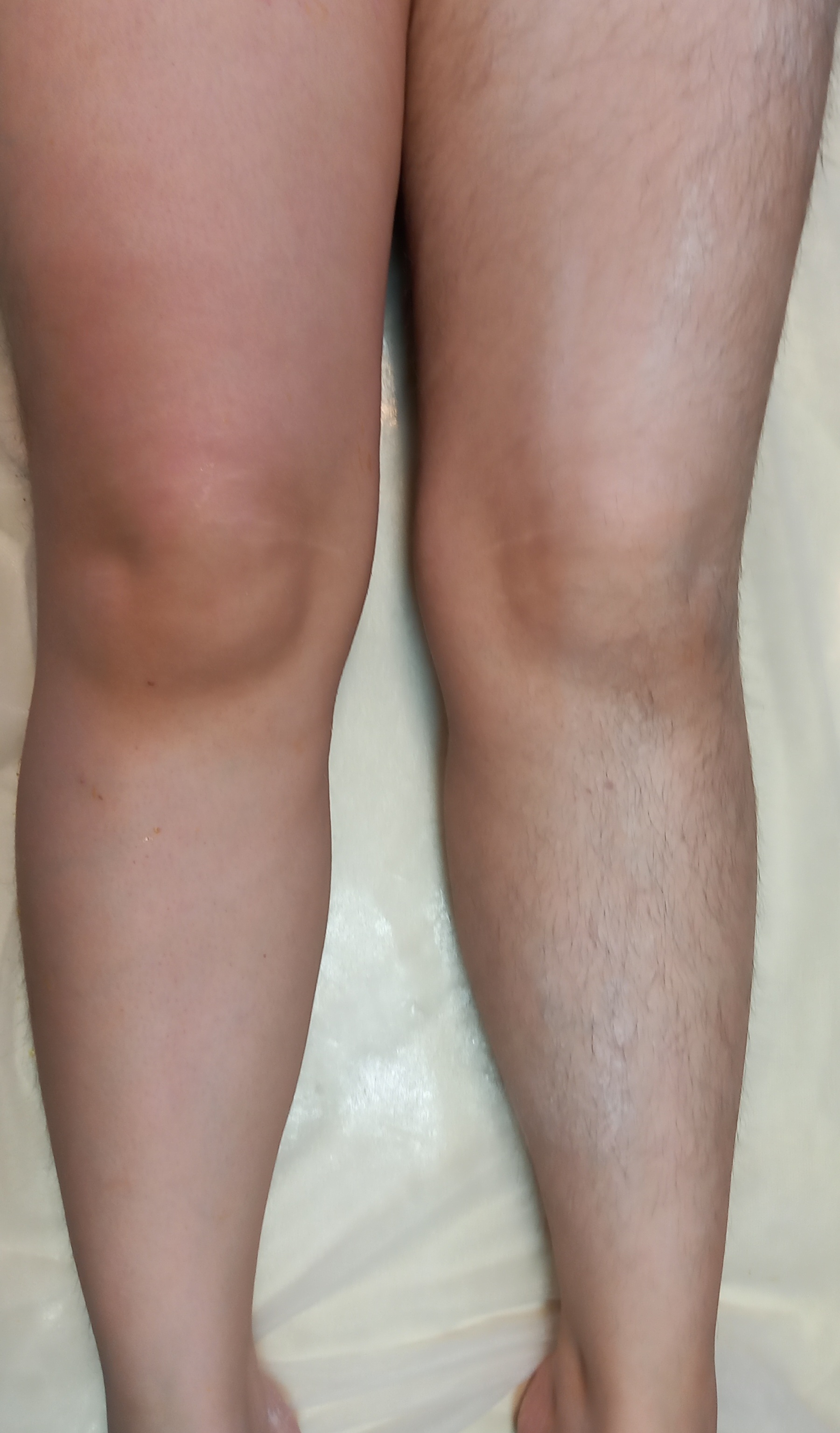 اپیلاسیونکار سیتا