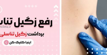 درمان زگیل تناسلی کلینیک زیبایی دلدار