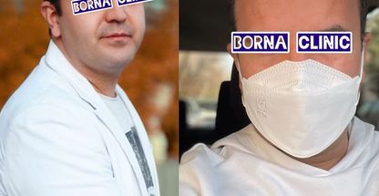 کلینیک تخصصی کاشت مو برنا تبریز