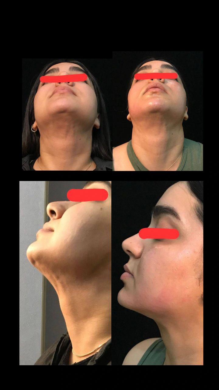 کلینیک زیبایی و لاغری زیباترشو