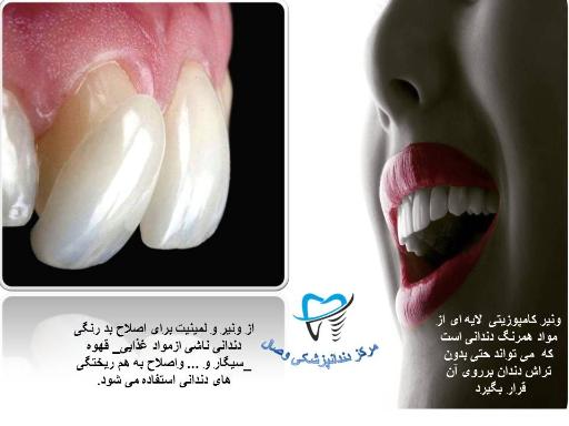 دندانپزشکی وصال شیرازی