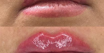 کلینیک پوست مو زیبایی و لیزر کهربا