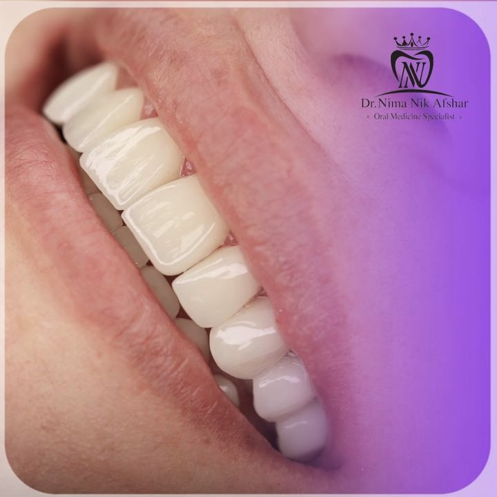 مرکز دندانپزشکی دیجیتال بابل ایمپلنت