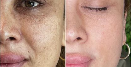 مرکز مراقبت پوست مو و زیبایی ویدیا