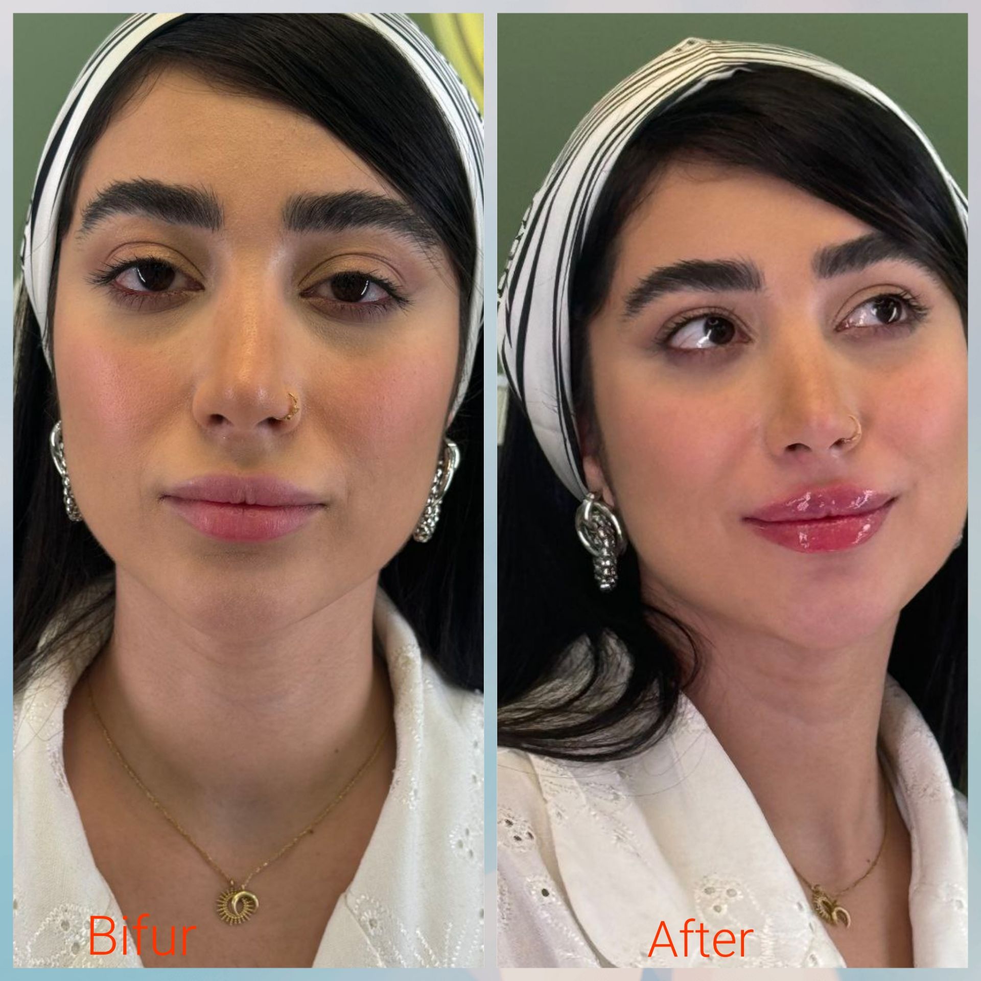 مطب زیبایی دکتر سیده زهرا حسینی