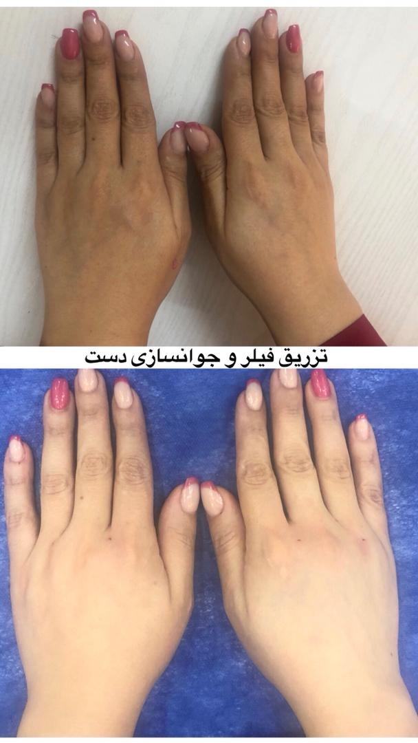 مرکز پوست و زیبایی دکتر شهلا وزیری نسب