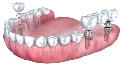 دندانپزشکی مطب دکتر هدیه هدایت زاده
