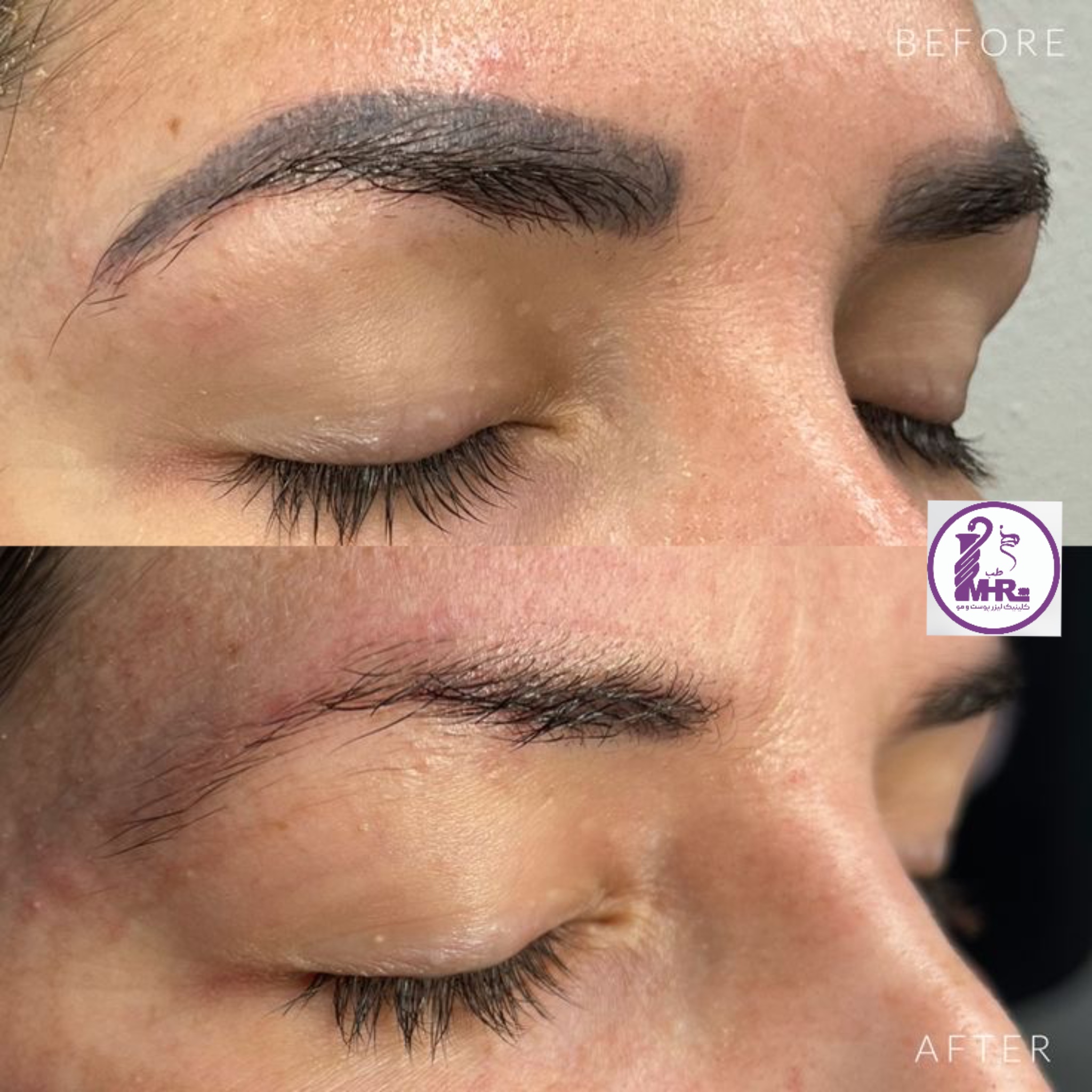 کلینیک پوست و لیزر مهر