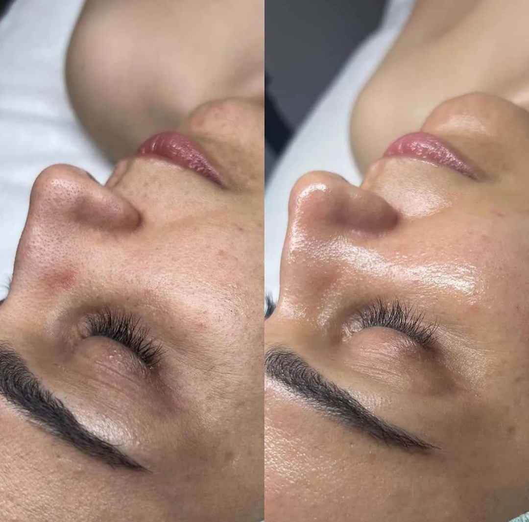 سالن تخصصی پاکسازی پوست بارانا