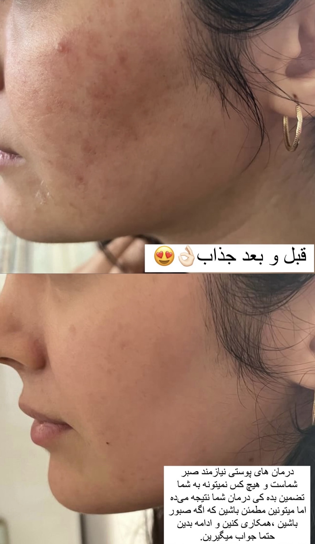فشیال و پاکسازی پوست