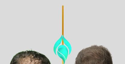 کلینیک تخصصی پوست و کاشت مو آوا