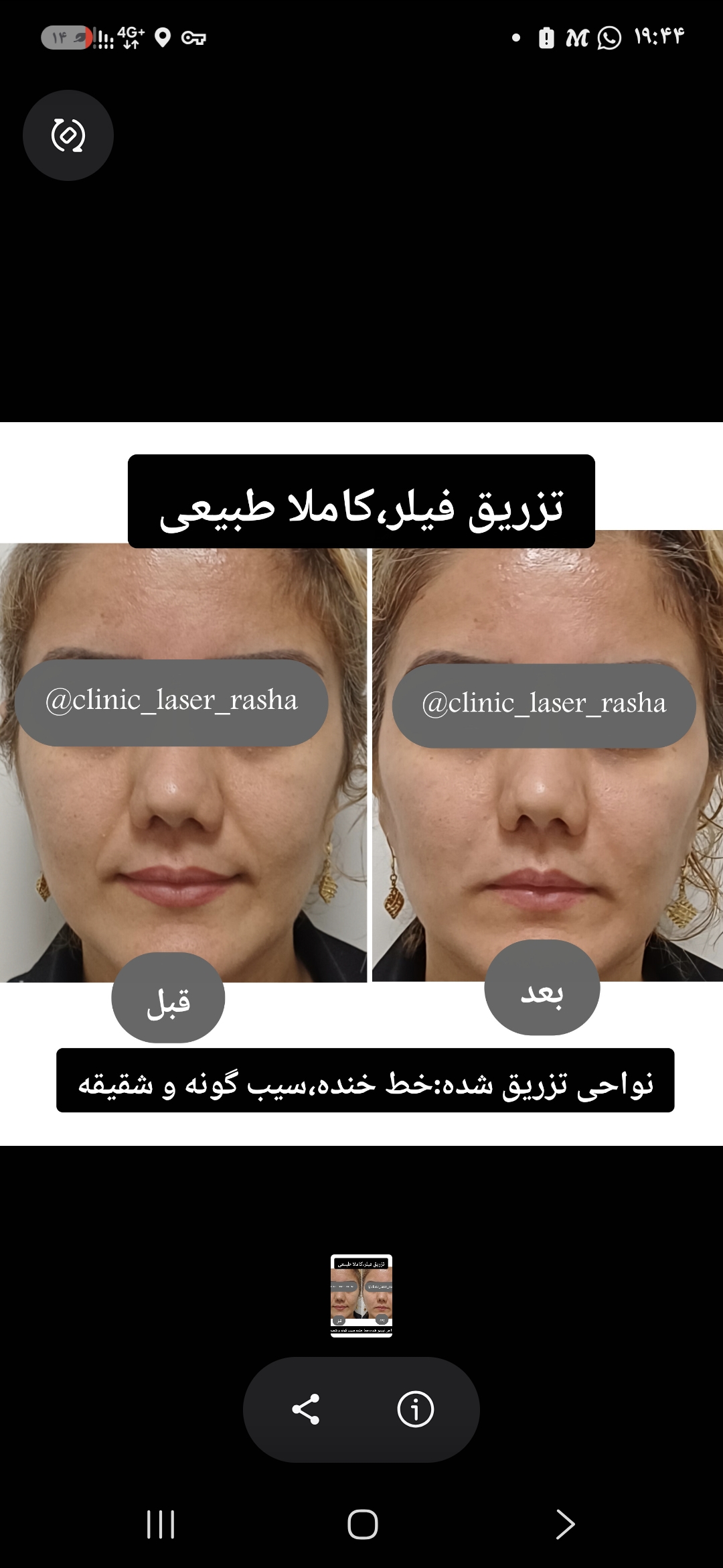 کلینیک تخصصی لیزر و زیبایی راشا