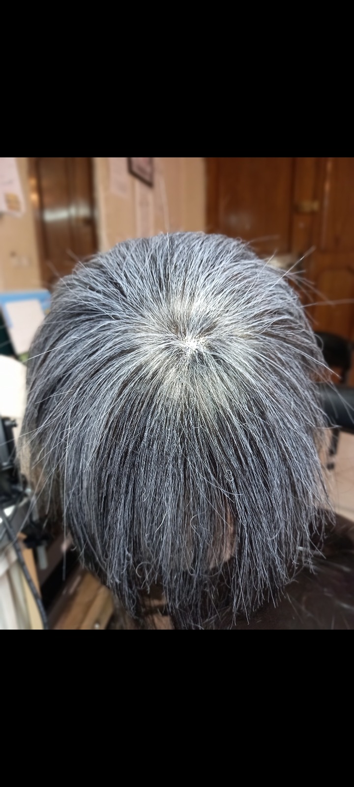 پروتز مو ویگ استار