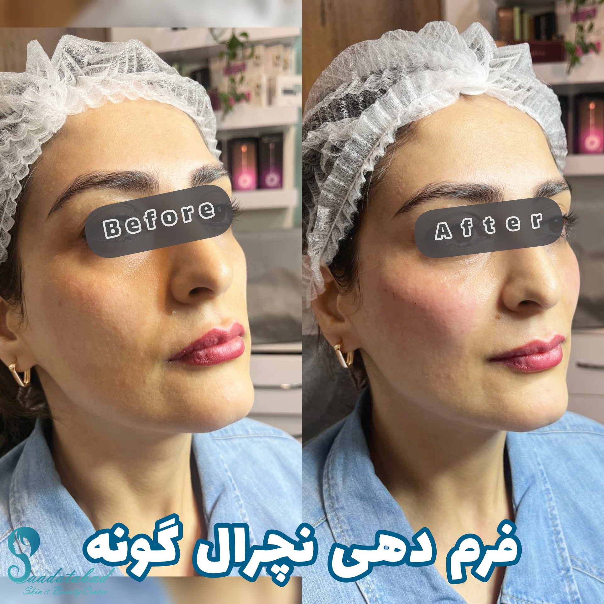 مرکز تخصصی لیزر و زیبایی سعادت آباد