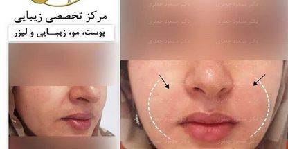 مرکز تخصصی پوست و مو دکتر مسعود جعفری