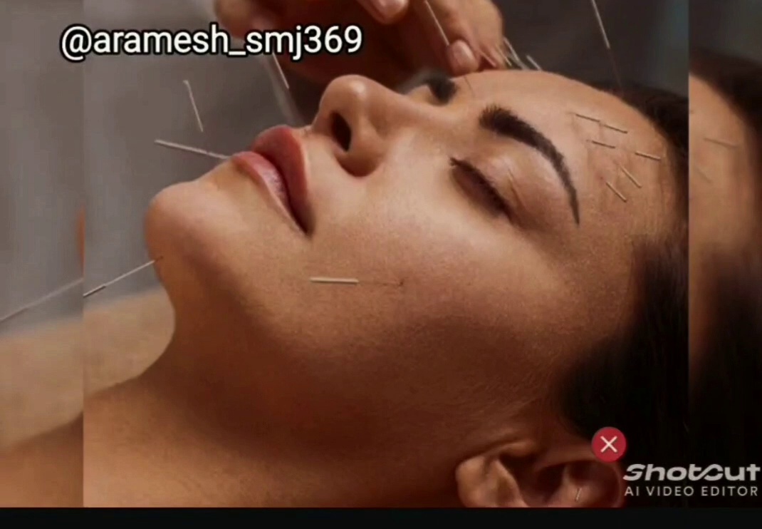 طب سوزنی زیبایی