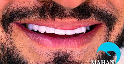 دندانپزشکی در منزل ماهان