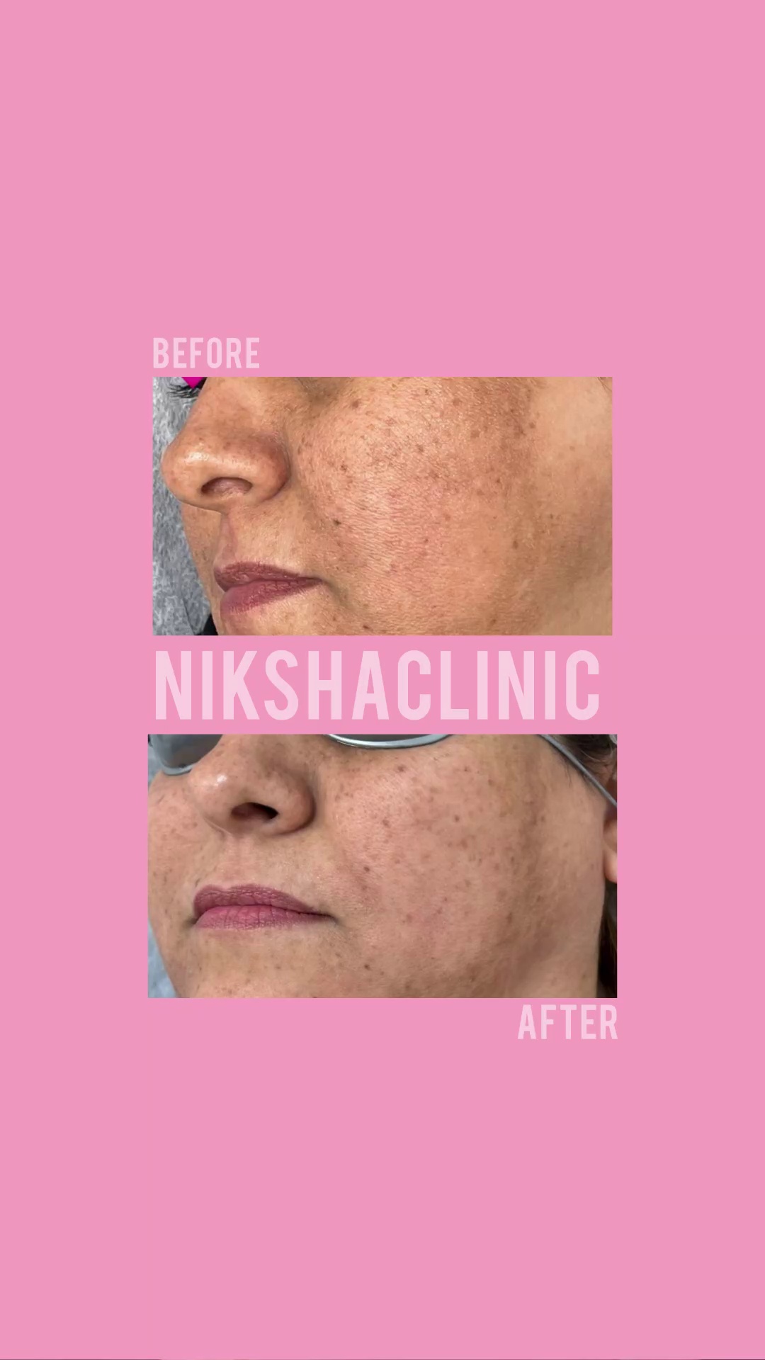 مطب زیبایی و مرکز لیزر نیکشا