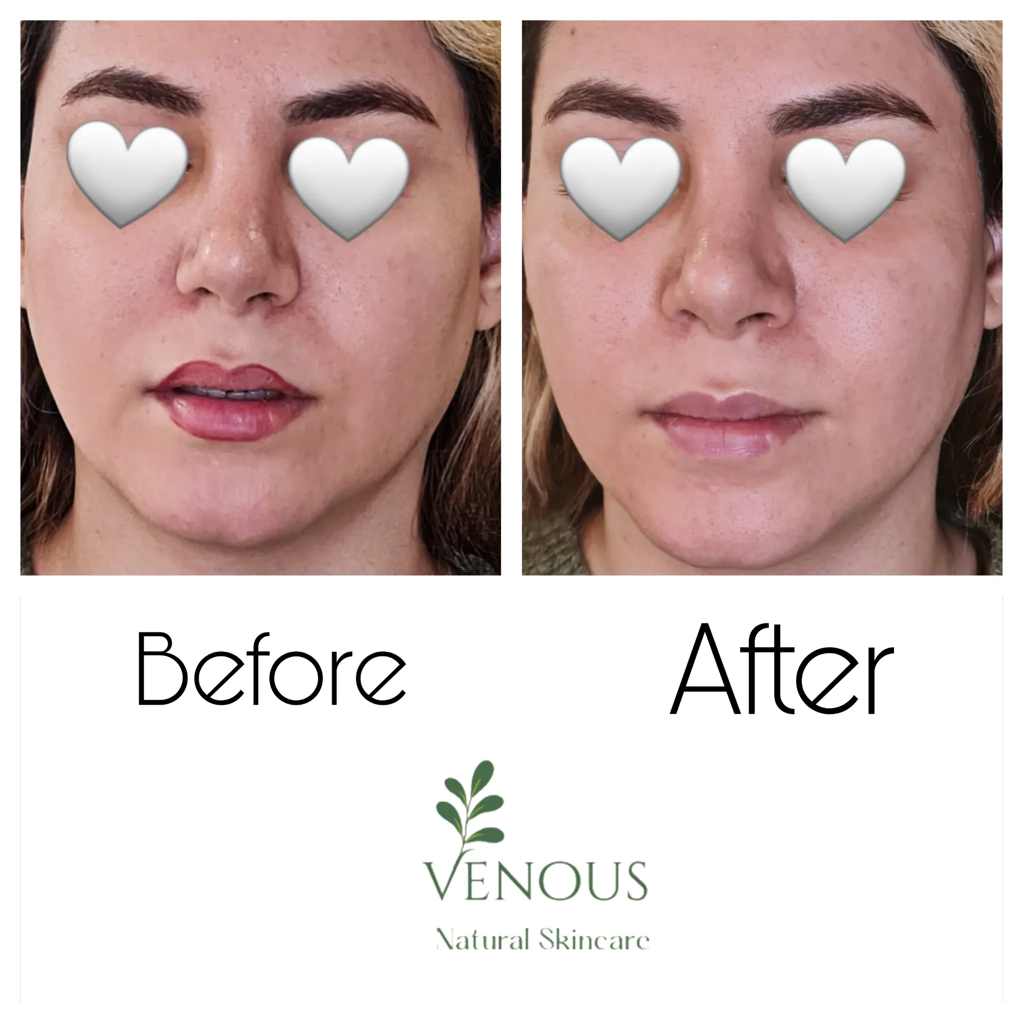 خدمات پوست ونوس