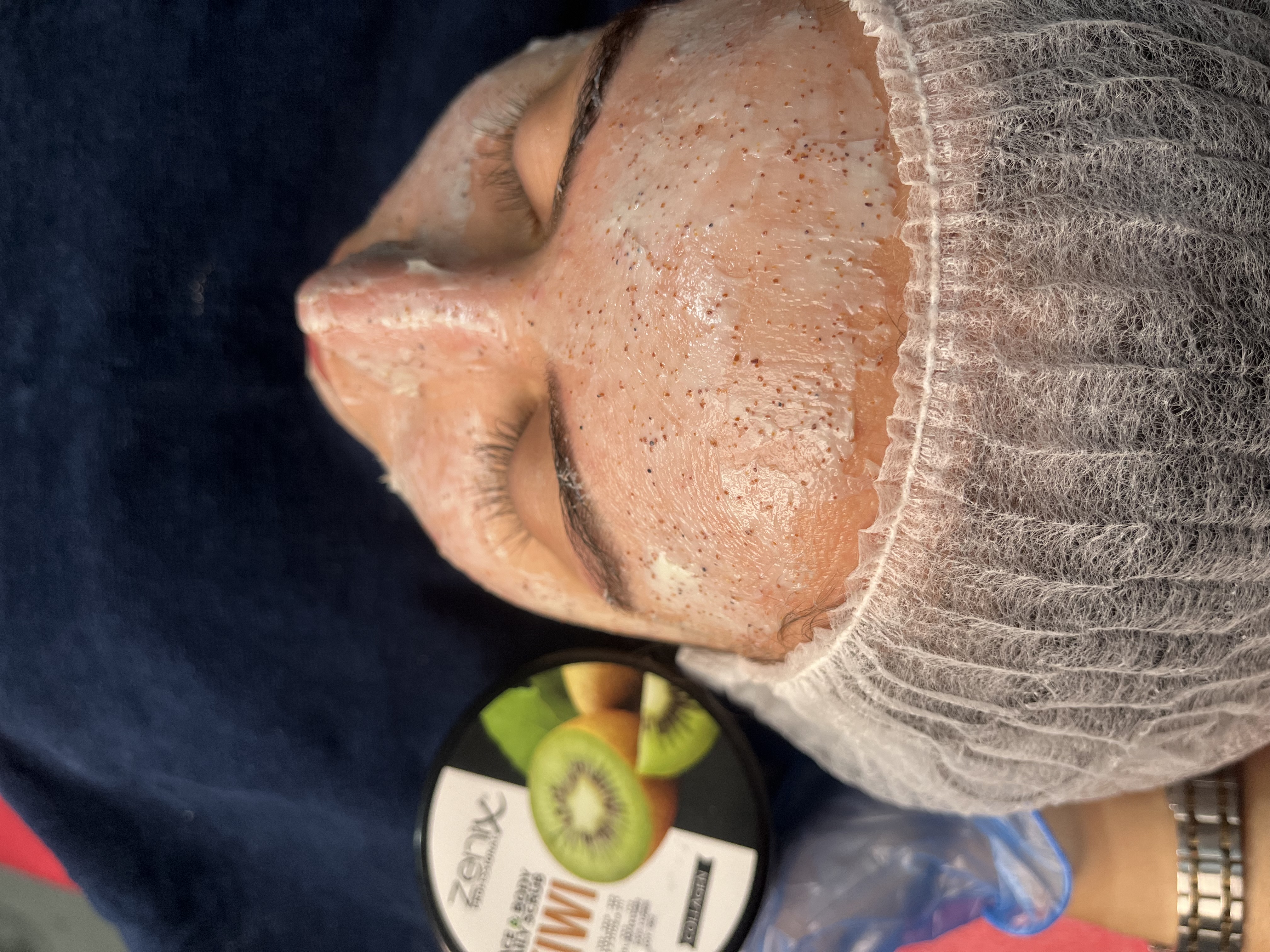 خدمات تخصصی فیشال  پوست رضوان