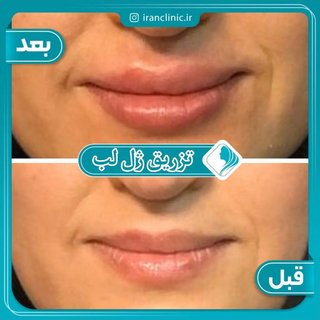 کلینیک تخصصی پوست، مو ،زیبایی ایران