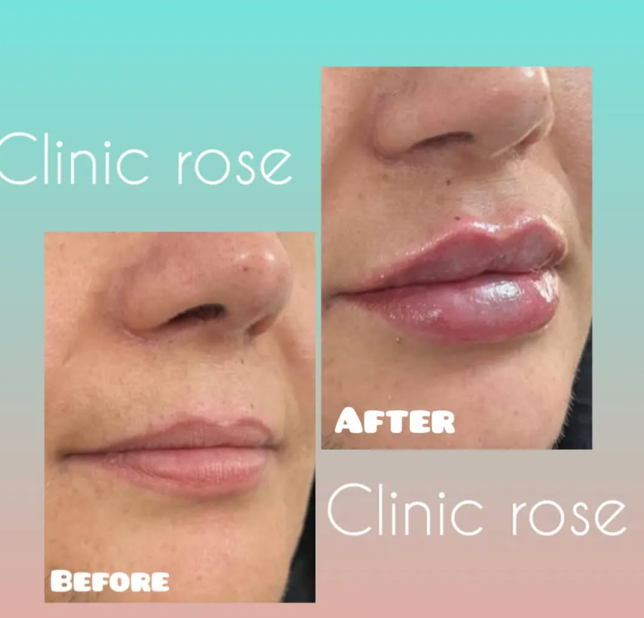 کلینیک زیبایی رز