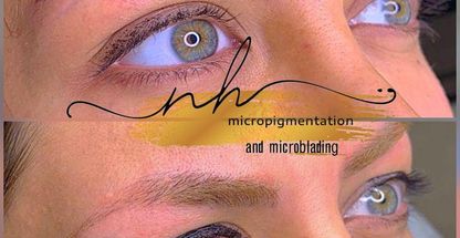 میکروبلیدینگ فیبروز حیدری