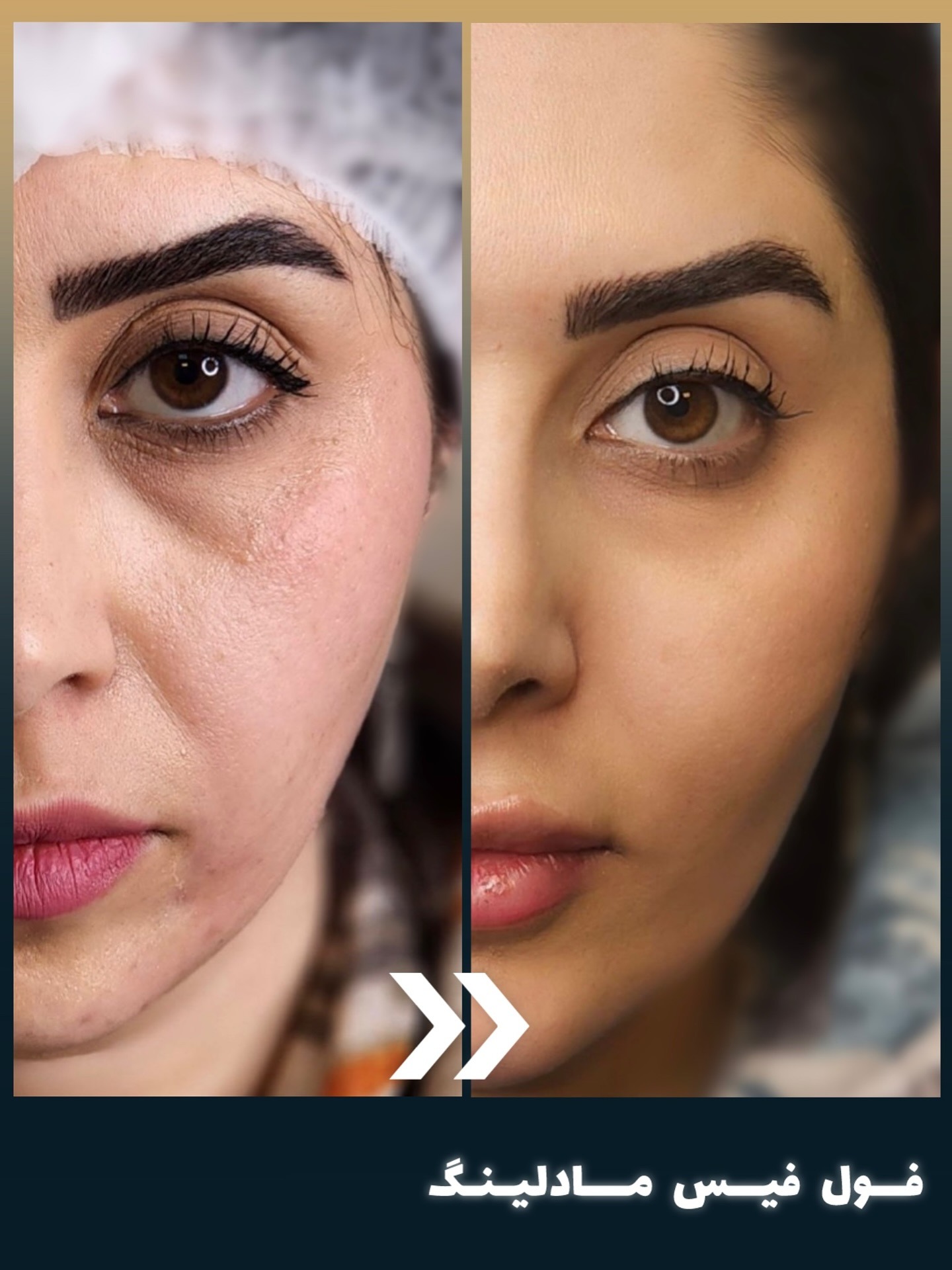 کلینیک زیبایی بنیتا